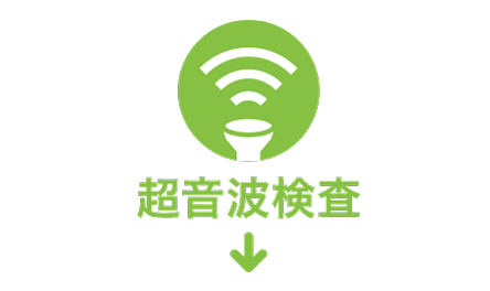 超音波検査