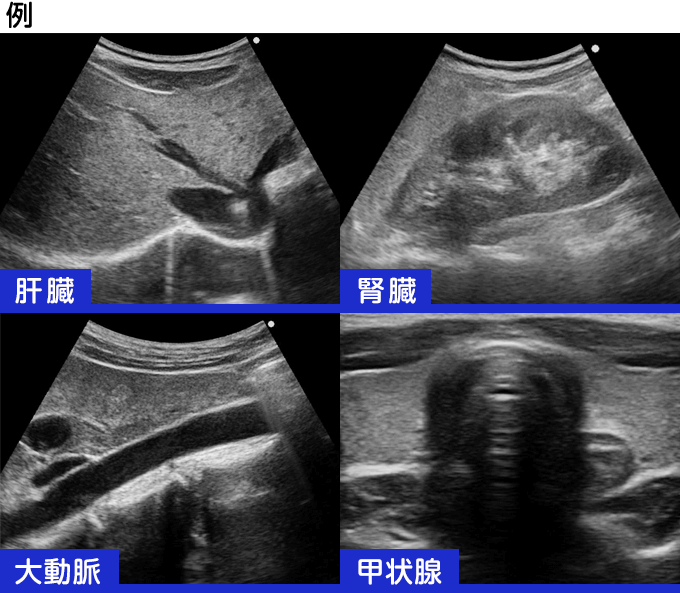 超音波検査イメージ画像