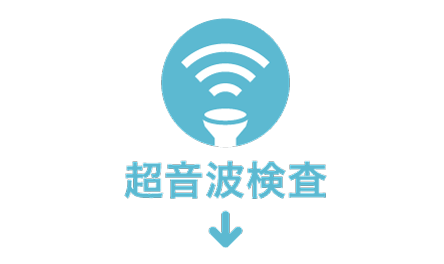 超音波検査