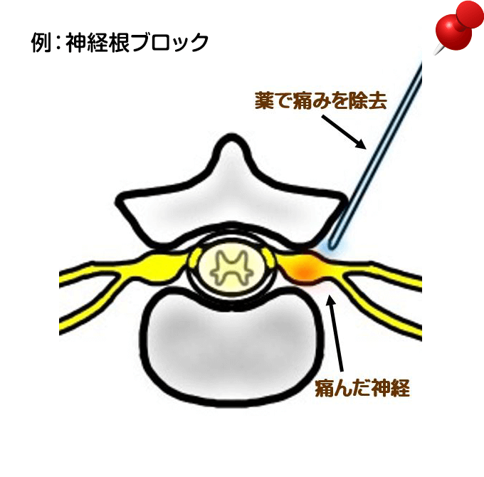 エコー写真