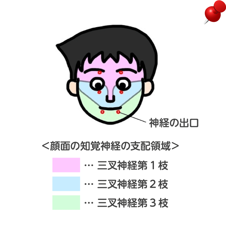 三叉神経痛イメージ図